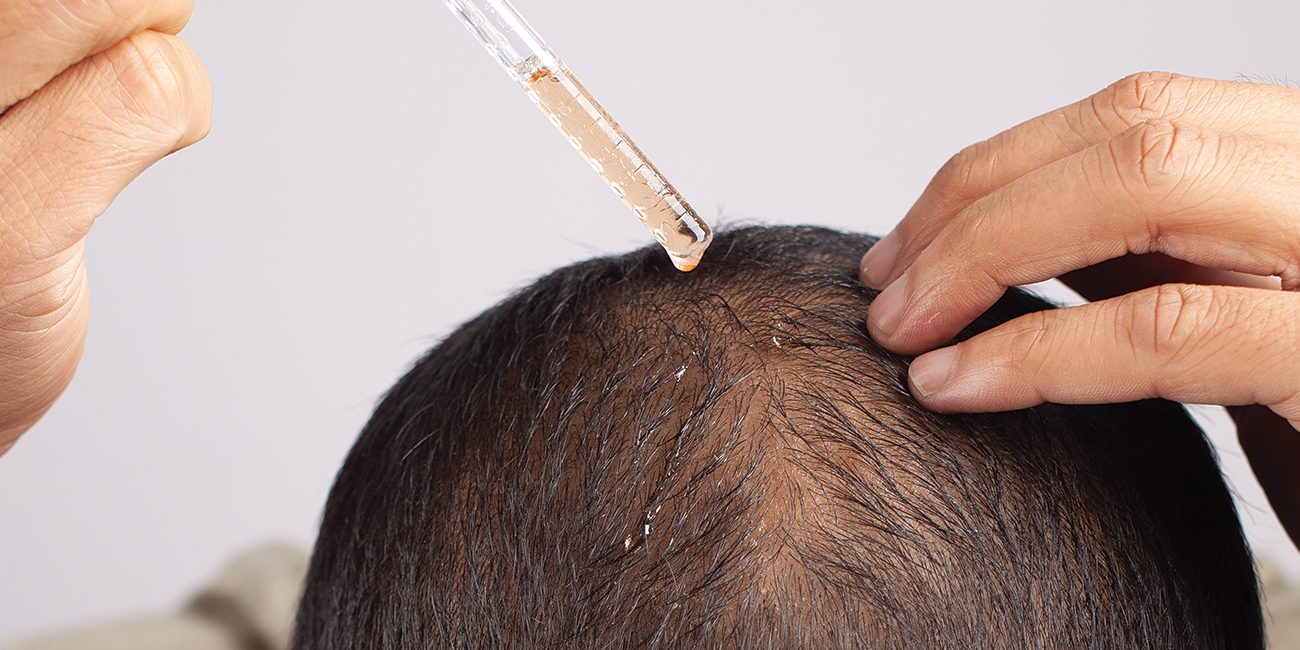 Guide-to-Usage-of-Forte-Hair-Serum