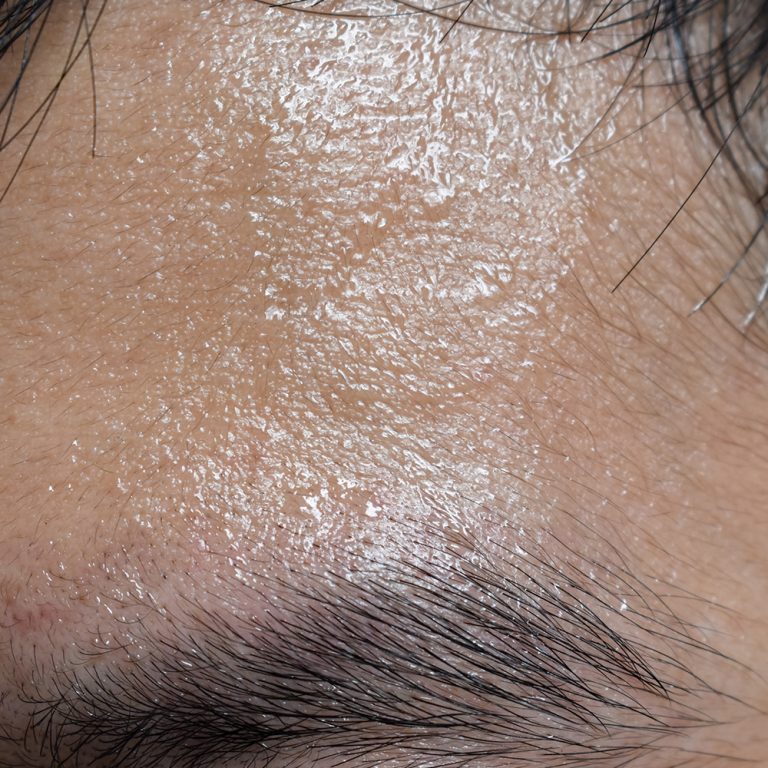 How-to-combat-an-oily-scalp
