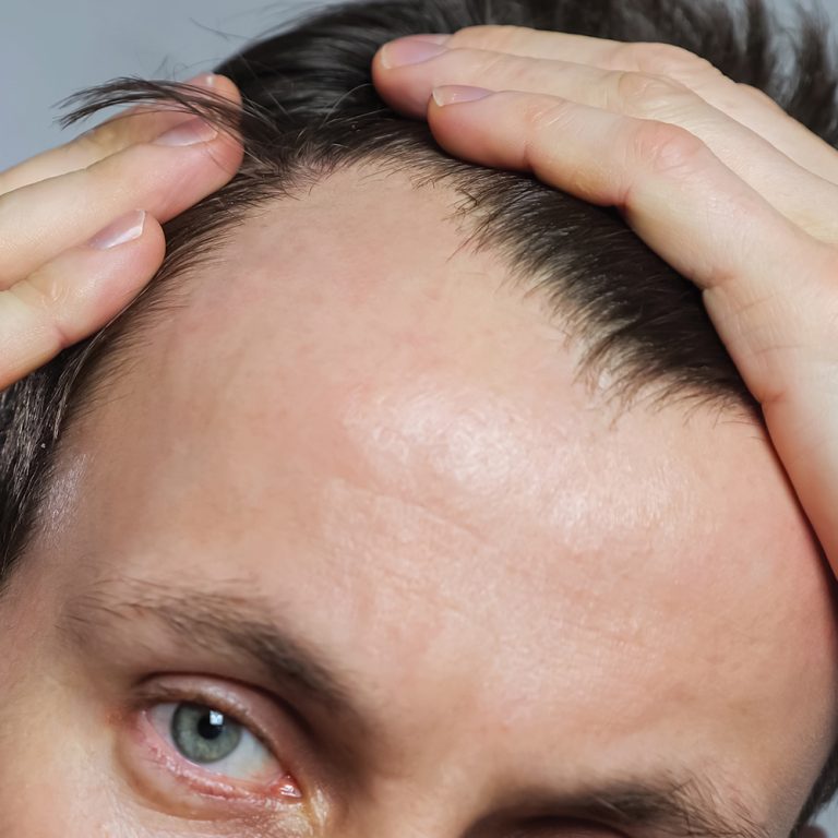 How-to-slow-down-hair-loss-with-shampoo